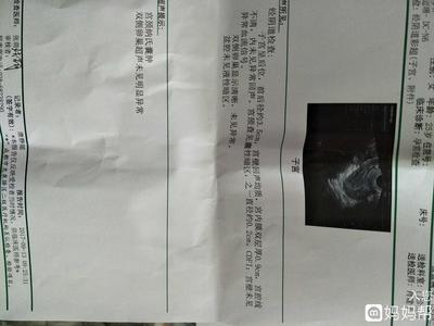 宫颈纳氏囊肿会影响怀孕吗