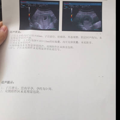 两个月堕胎