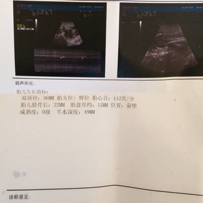 十八周胎儿发育图片