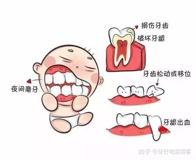 蛀牙引起的牙疼怎么办