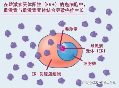雌激素多少高可以诱发乳腺癌