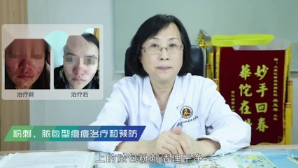 吴玉琴治疗痘痘怎么样