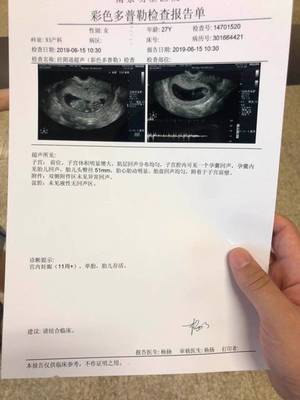 怀孕两天会恶心吗