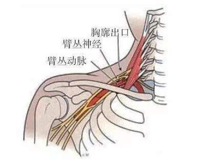 肋骨抽筋疼是怎么回事