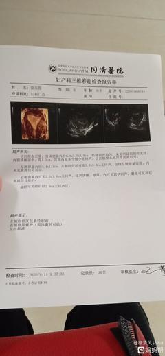 输卵管有积液是怎么回事