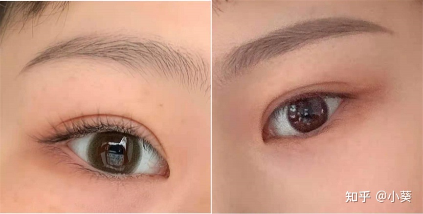 全切双眼皮照片