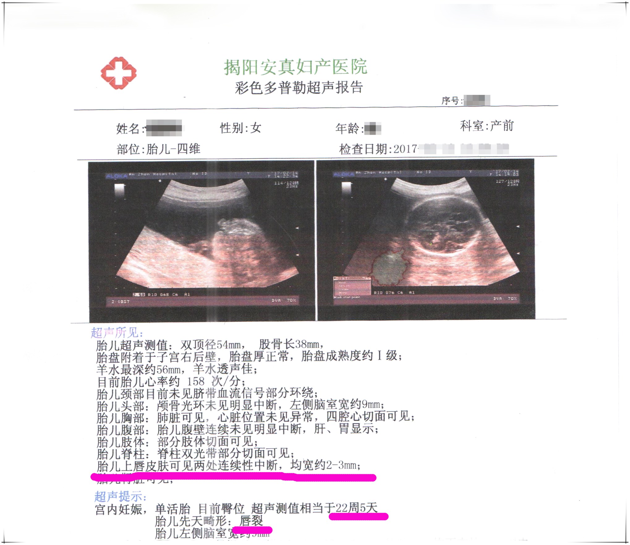 孕3个月胎儿图