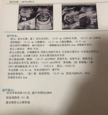 孕妇需要做心脏彩超吗