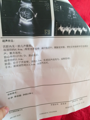 胎儿一般多久有胎心
