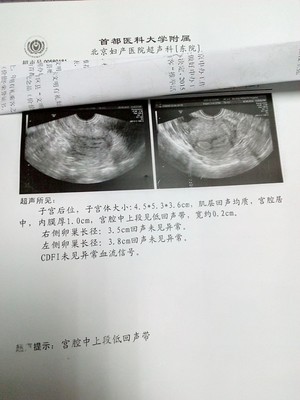 什么检查能查出怀孕