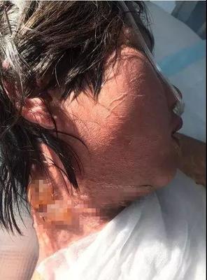 全身烫是怎么回事