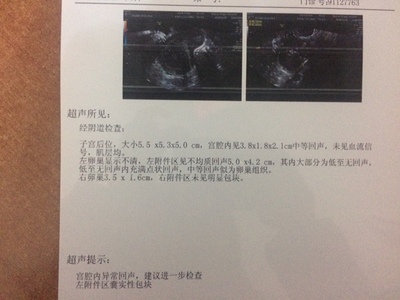 巧克力囊肿手术后多久可以怀孕