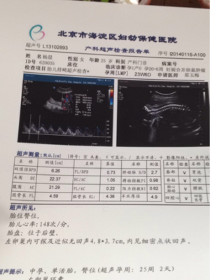 胎儿心率148