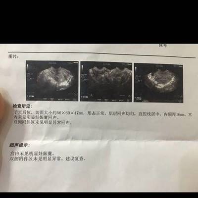 怀孕多久后恶心