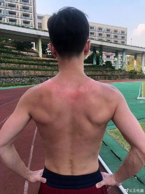 后背心疼是怎么回事