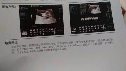 怎么测试男女宝宝最准