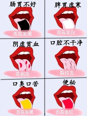 口苦舌苔白是怎么回事