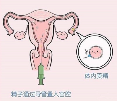 多少精子可以怀孕
