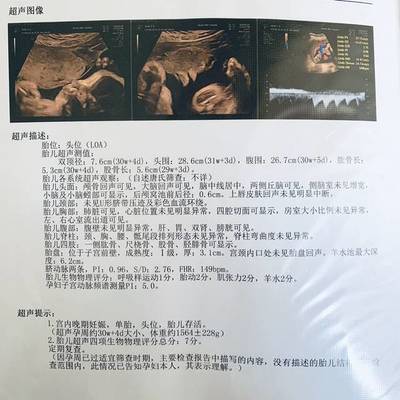 做dr后多久可以怀孕