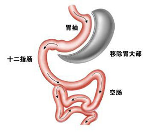 胃饥饿感是怎么回事