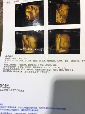 孕36周后胎儿一周一般能长重