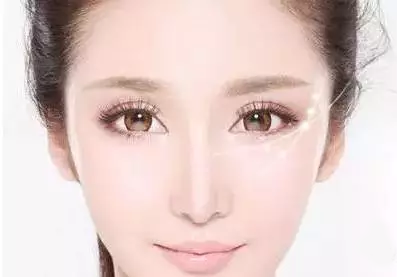 美丽的双眼皮