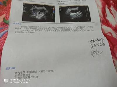 怀孕初期少量出血正常吗