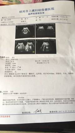32周胎儿