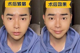 粉毒可以除皱吗