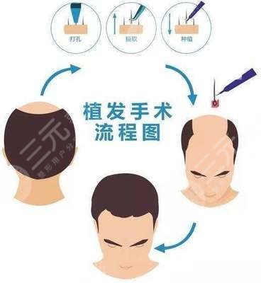 中医去疤痕
