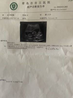 怀孕12周见红了有事吗