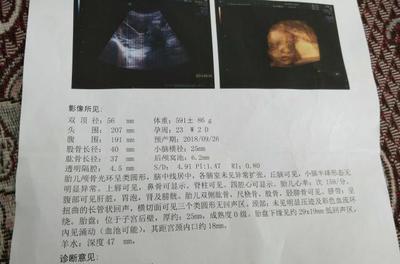 胎儿几个月发育听力