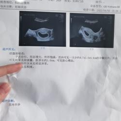怀孕两个月能做吗