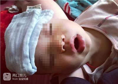 宝宝烧坏脑看的出来吗