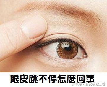 认识一下《左眼皮跳跳!右眼皮跳跳!好事要来到?好眼皮跳症状起因?眼皮跳测吉凶》健康知识收藏