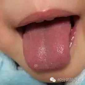 宝宝内火大怎么办
