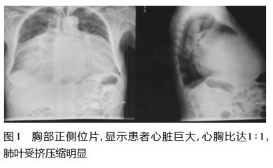 肺衰竭怎么治疗