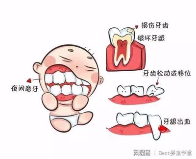 孩子磨牙是怎么回事