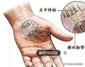 手指头尖麻是怎么回事