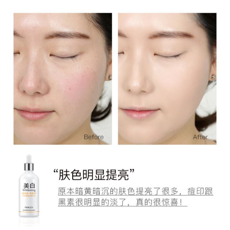 痘痘肌肤可以用精华液吗