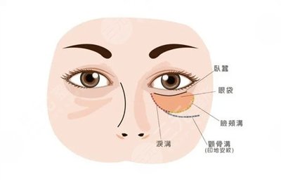 小宝宝卧蚕眼图片