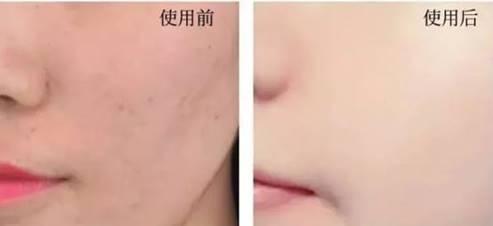 用洗面奶脸上干燥起皮