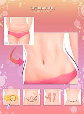腰腹抽脂需要多少钱