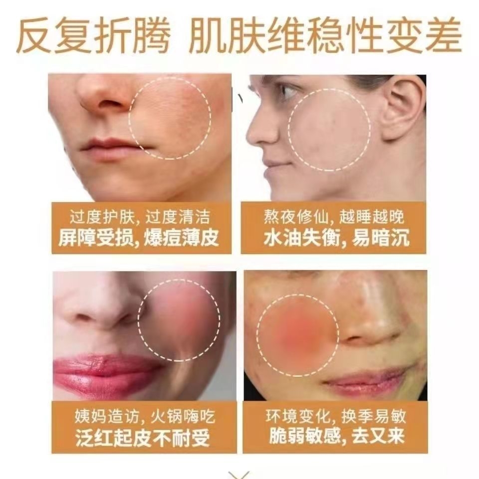 有痘痘用修复屏障