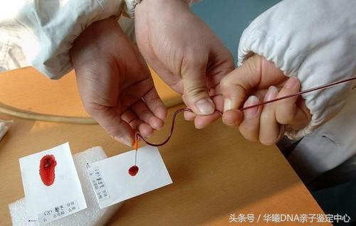 亲子鉴定多久出结果