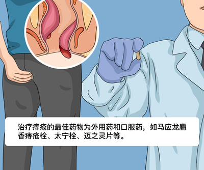 得了痔疮要怎么治疗