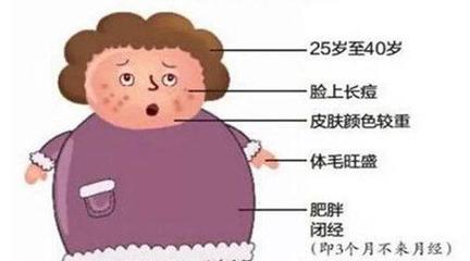 几个月不来月经算闭经