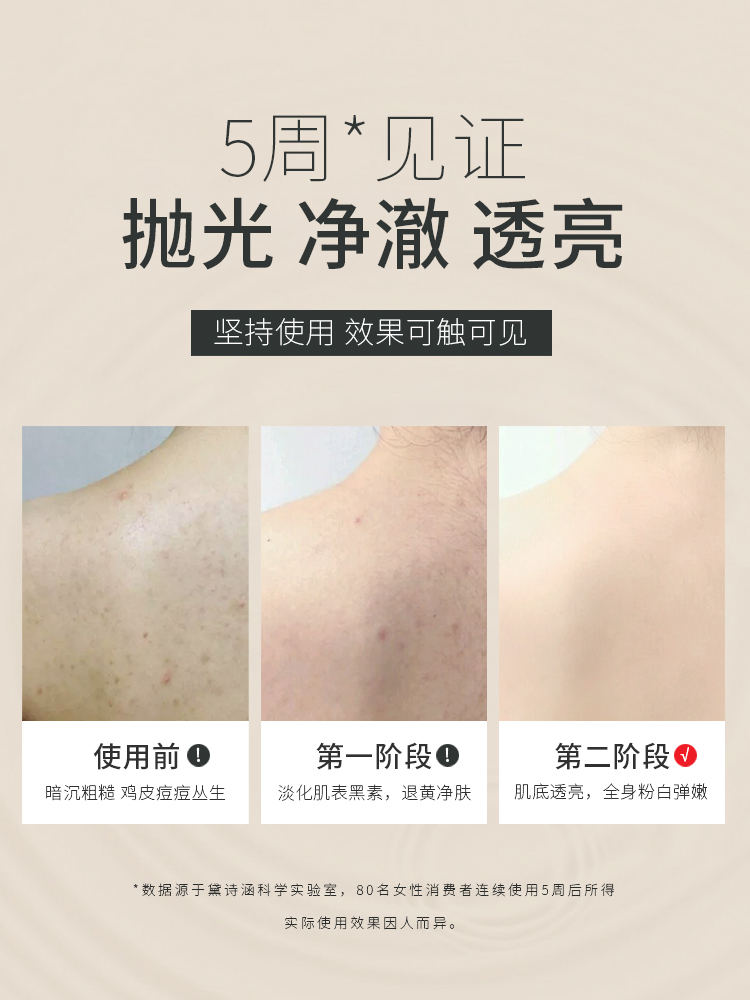 痘痘肌肤用什么牌子最好