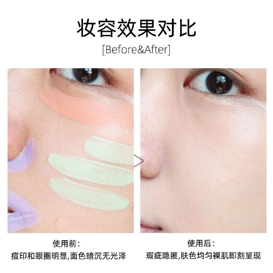 痘痘能不能遮瑕膏