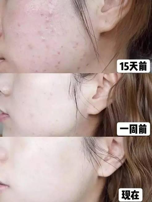 用洗面奶脸上干燥起皮